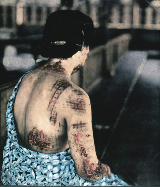 Vrouw Hiroshima